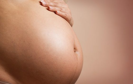 Hamilelikte Çatlaklar Nasıl Önlenir?